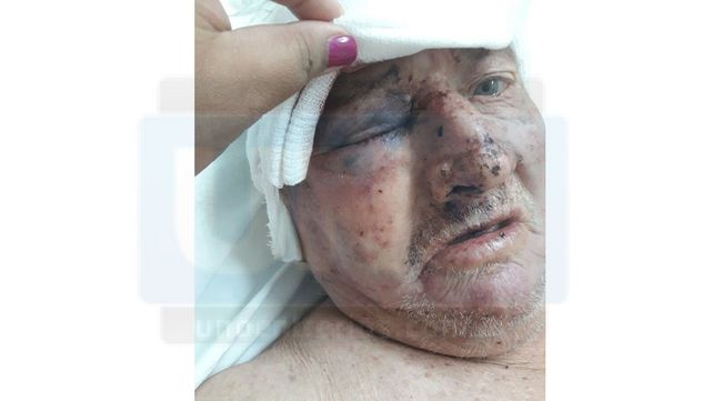 Sigue internado el taxista que golpearon con un palo para robarle 350 pesos
