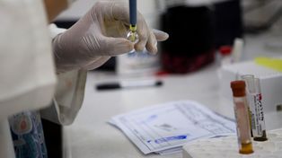 Confirmaron en Estados Unidos la transmisión del virus zika por contacto sexual