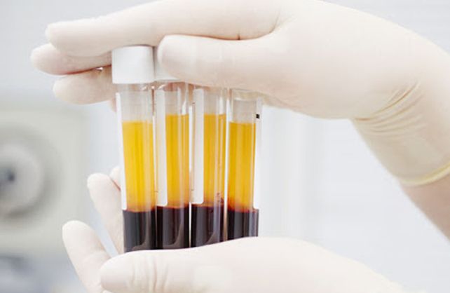 El Ministerio de Salud insiste con que el plasma puede ser beneficioso pero no curar