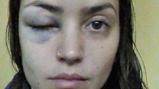 Así le quedó la cara tras el golpe que recibió. 