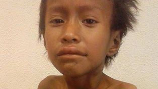 Conmoción por la muerte de un niño qom desnutrido