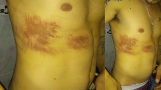 No hay justificativo para este accionar de las fuerzas de seguridad