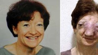Confirman que la francesa a la que le negaron la eutanasia se suicid&oacute;
