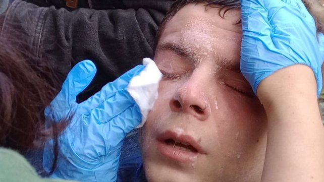El fotógrafo Antonio Becerra que tomó imágenes de Santiago Caputo fue herido durante la marcha de jubilados frente al Congreso.&nbsp;