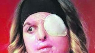 Una modelo reveló cómo le dejó la cara su ex novio tras atacarla