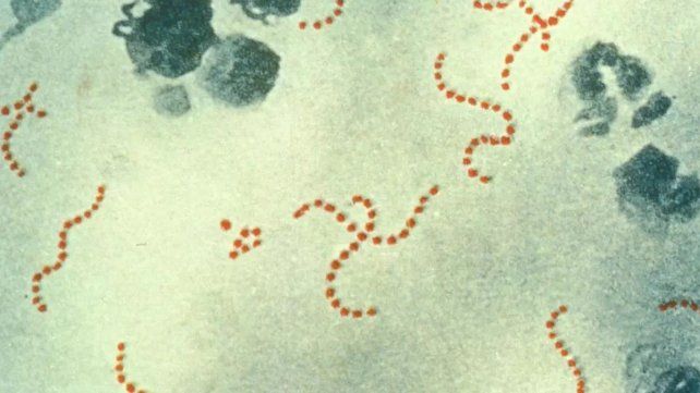 El ministerio de Salud de la Nación notificó 118 casos de infección invasiva por streptococcus pyogenes en el país y 16 fallecidos. Qué es y cómo se contagia&nbsp;