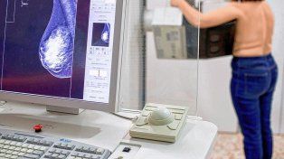 Puede ser un buen momento para hacerse una prueba para detección del cáncer de mama