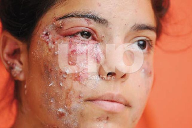 “No hay forma de detectar un artefacto explosivo casero”