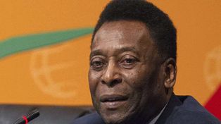 Pelé, operado de urgencia por cálculos biliares
