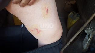 Mató a un caniche y mordió a dos personas