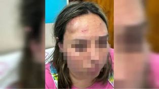 Madre e hija atacaron a golpes a una docente y le desfiguraron el rostro