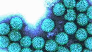 Los cinco bebés que fallecieron en Buenos Aires tenían rotavirus