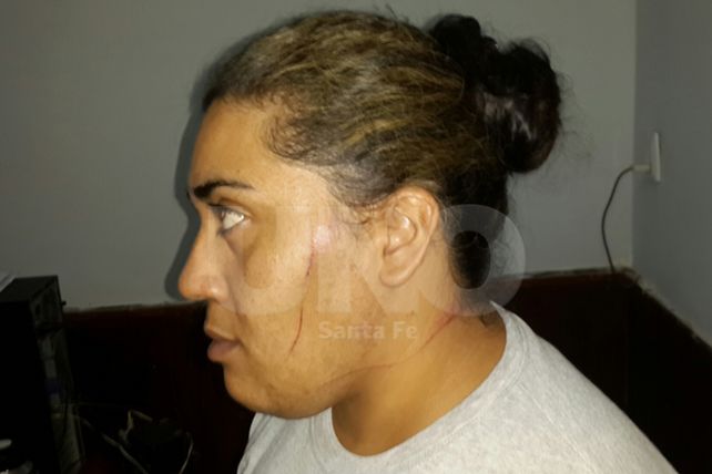 Una mujer policía resistió un asalto y baleó a un delincuente