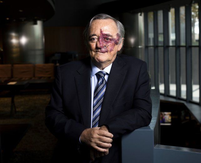 Barbacid sale a limpiar el hallazgo de la terapia contra el cáncer de páncreas