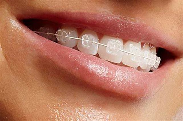 La exposición en fotos y redes aumentó los pedidos de tratamientos odontológicos.