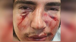 Tres rugbiers golpearon salvajemente a un joven en un country en Córdoba
