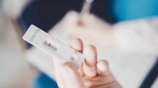 ¿Cuál es el momento adecuado para hacer autotest o hisopado en laboratorio?