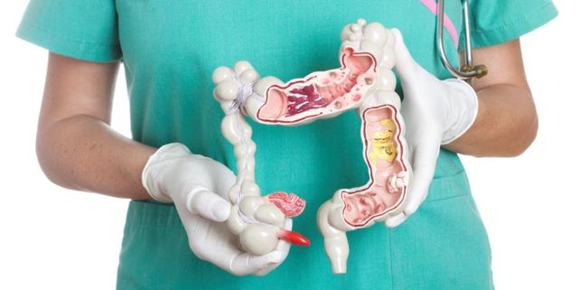 El Ministerio de Salud realizará una charla abierta sobre cáncer de colon en Santa Fe