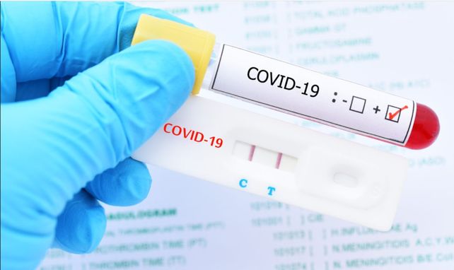 ¿Por qué una persona con coronavirus puede tener un test negativo?