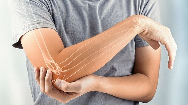 La osteoporosis produce dolores en distintas partes del cuerpo