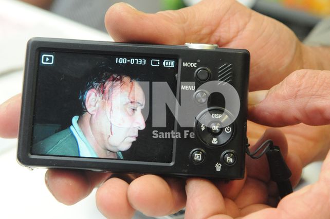 La víctima de los bandidos este jueves le mostró a UNO una foto tomada el lunes