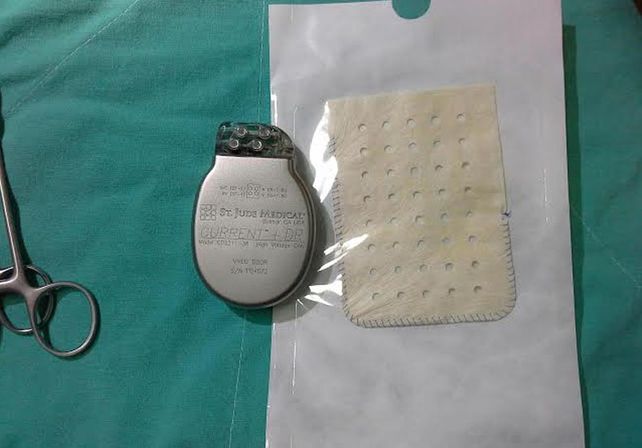 Elementos que se utilizaron en la novedosa intervención./ Secretaría Comunicación Social.