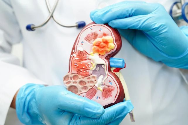 Trasplante renal: más bienestar para el paciente y el donante