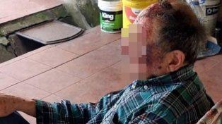 Violento asalto a jubilado: arrestaron a cinco implicados y recuperaron parte del dinero