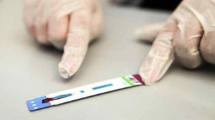 Los casos de sífilis crecieron hasta 71% en 2025 y alcanzaron un récord en Argentina