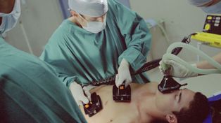 Uno de cada cuatro hipertensos no está controlado