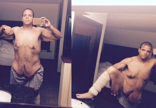 Un hombre logró bajar más de 150 kilos después de dos años de esfuerzo