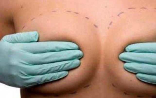 Cirugía estética. Las querellantes pidieron una acción colectiva.