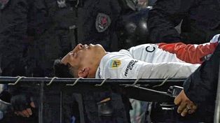 Aliendro sufrió una dura lesión en el Superclásico.