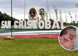 San Cristóbal se moviliza por Delfina, la adolescente de 15 años atacada brutalmente por una patota de menores
