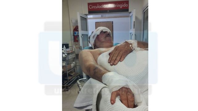 Sigue internado el taxista que golpearon con un palo para robarle 350 pesos
