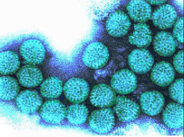 Los cinco bebés que fallecieron en Buenos Aires tenían rotavirus