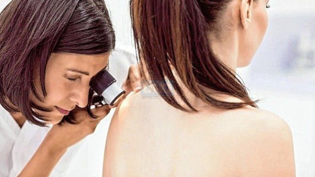 La próxima semana tres consultorios médicos móviles visitarán la ciudad de Concordia para realizar exámenes de lunares y manchas en el marco de una concientización sobre el cáncer de piel. La convocatoria es libre y gratuita.&nbsp;
