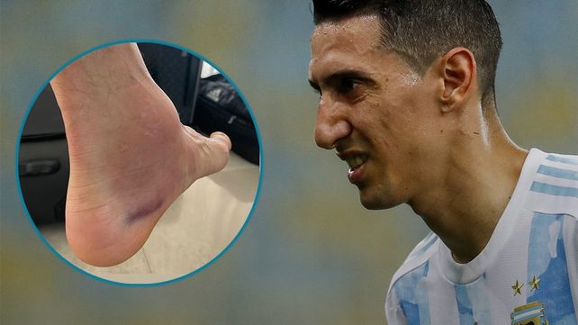 A casi 48 horas de la final ante Brasil