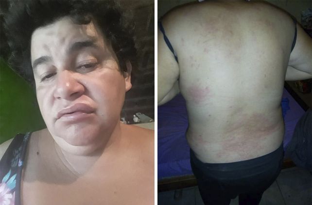 Norma Cabrera denunció además que con posterioridad a las aspersiones tuvo episodios negativos en su salud que fueron constatados por médicos legistas y presentados en la causa.