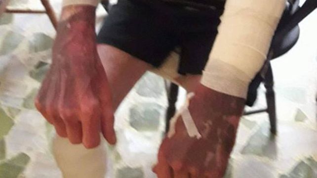 Apuñalaron, golpearon y ahorcaron a un hombre de 64 años para robarle