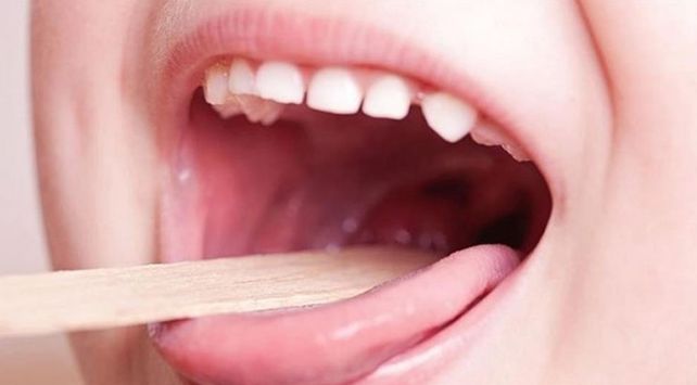 Recomendaciones sobre la bacteria estreptococo pyogenes