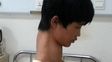 El chico jirafa sorprende a China que busca soluciones para acortar su cuello