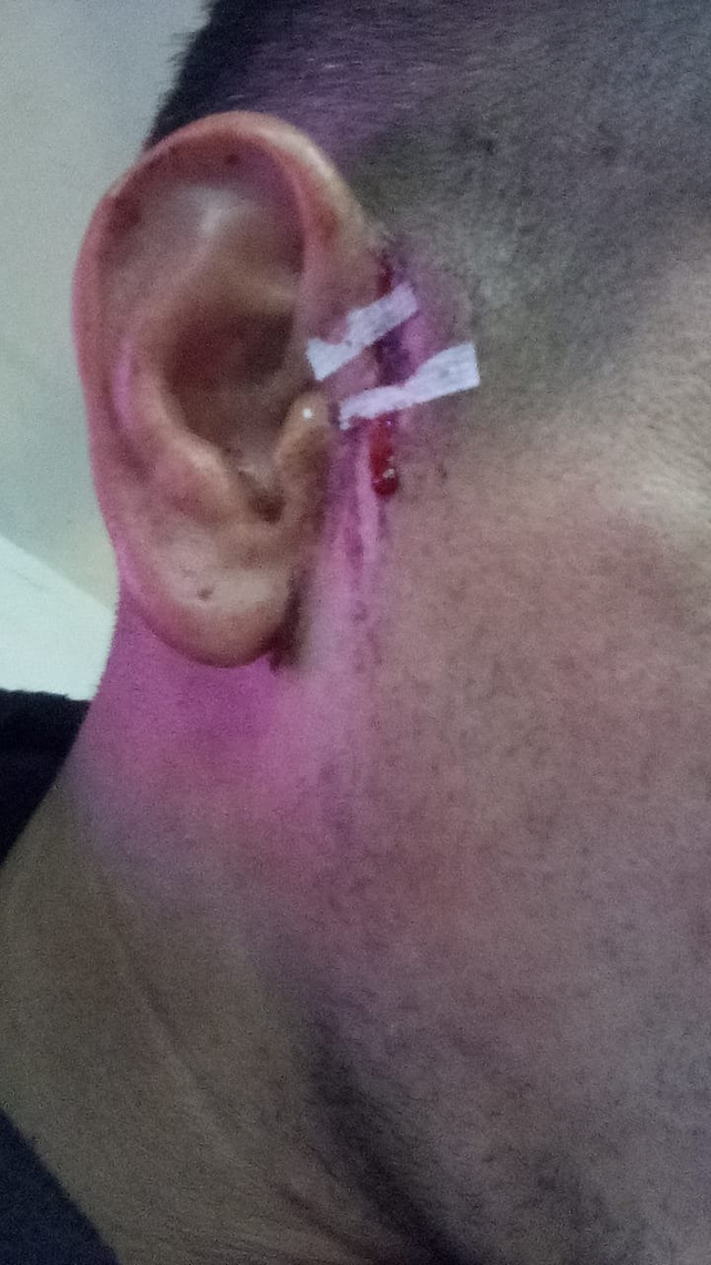 Así quedó el agredido en el partido de la Liga Santafesina. Llamativamente no quiso hacer la denuncia.