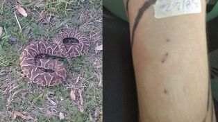 La picó una yarará en la costanera santotomesina