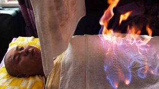 Los “doctores” chinos que curan con fuego las enfermedades