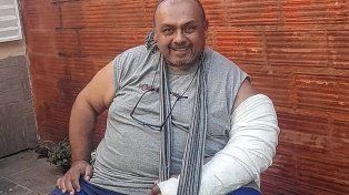 Villaguay: piden colaboración para un hombre que necesita una prótesis