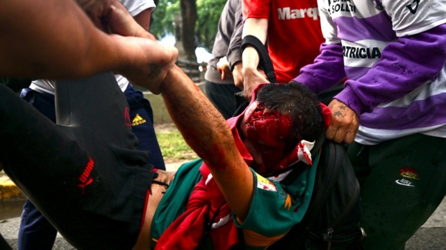 Un fotógrafo herido de gravedad durante la represión en el Congreso: el video del momento y lo que dijo Bullrich