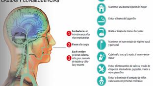 Falleció un niño de seis años por un caso de meningitis