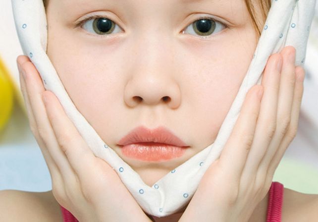 Recomendaciones de Salud por casos de paperas en la provincia