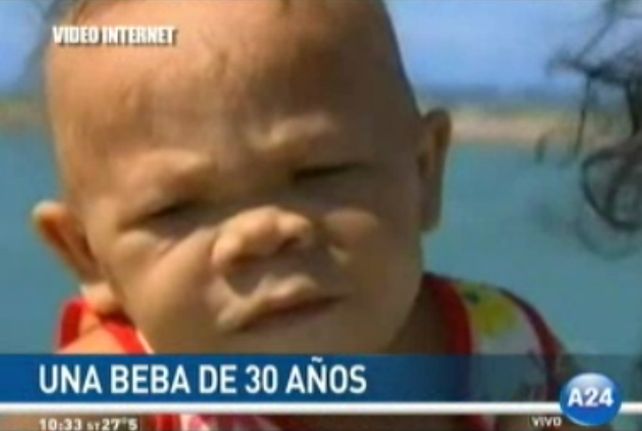 La mujer que vive en el cuerpo de una bebé